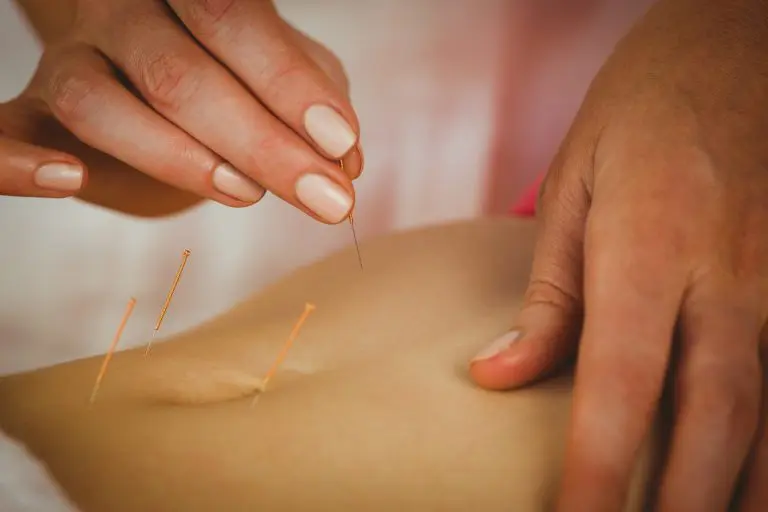 The Power of Acupuncture: Restoring Balance Naturally